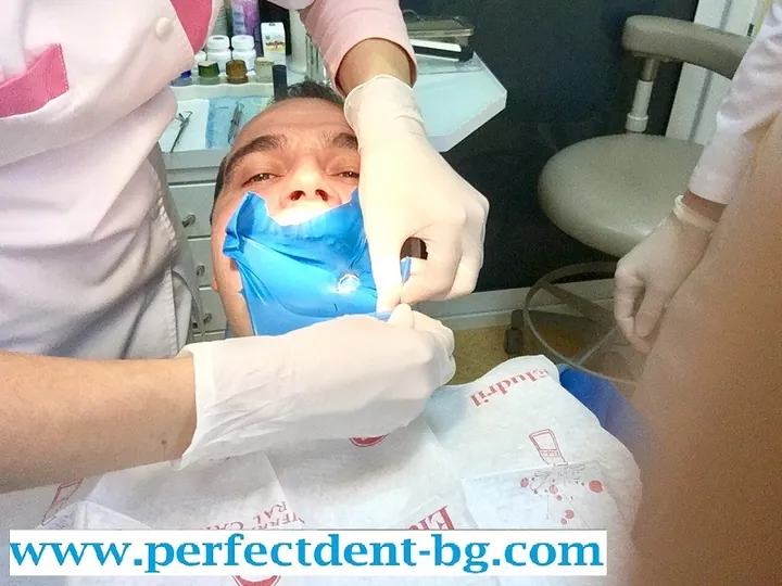 Пациент в Dental Studio Perfect с поставен син кофердам